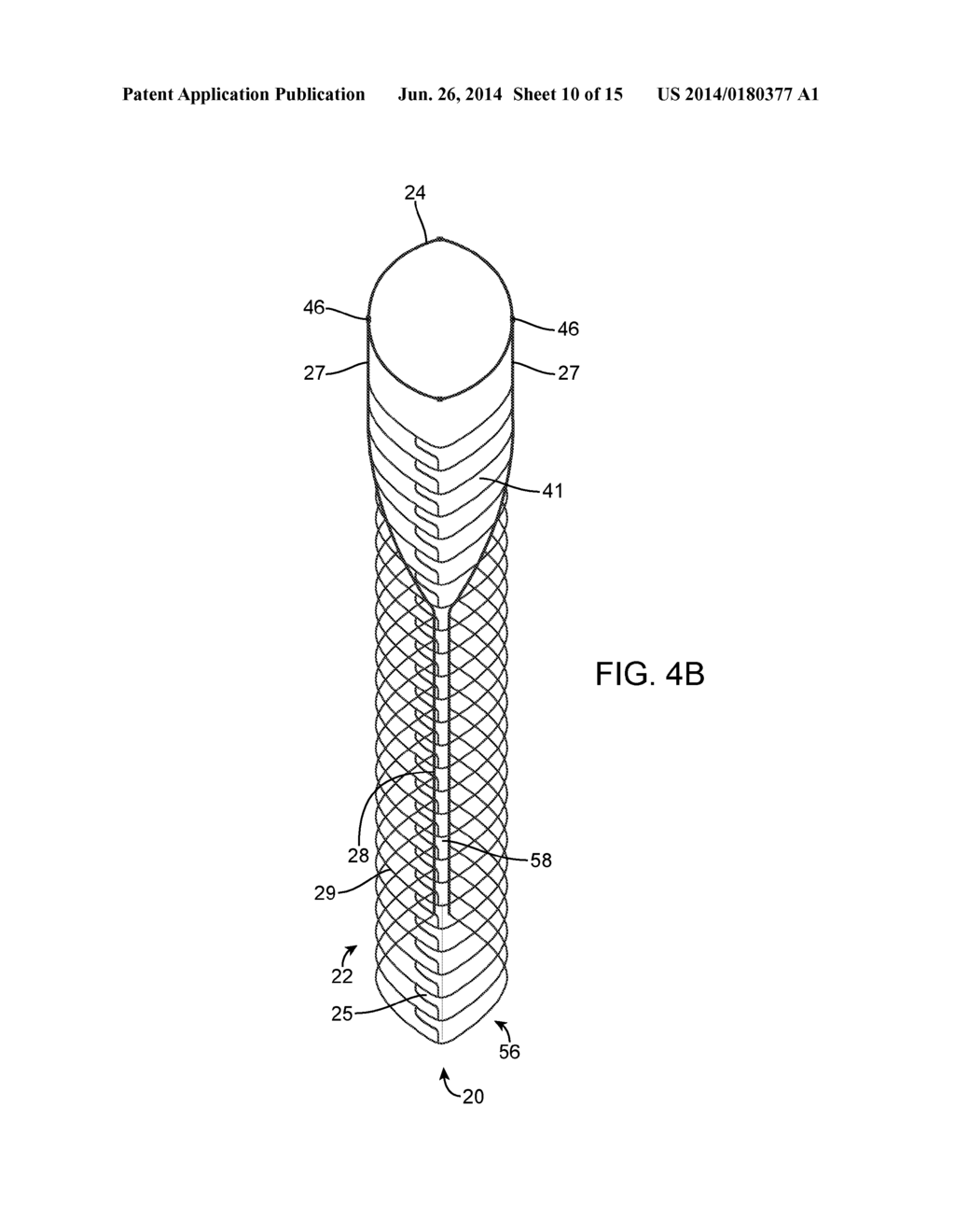 ANEURYSM OCCLUSION SYSTEM AND METHOD - diagram, schematic, and image 11