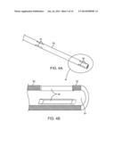 IMPLANT DELIVERY ASSEMBLY AND METHOD OF USE diagram and image