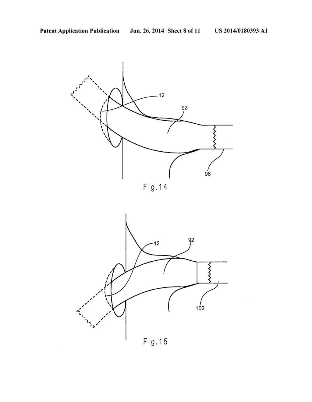 PROSTHESIS HAVING PIVOTING FENESTRATION - diagram, schematic, and image 09