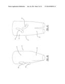 ENDOLUMINAL PROSTHESIS HAVING MODULAR BRANCHES AND METHODS OF DEPLOYMENT diagram and image