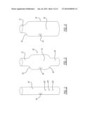 ENDOLUMINAL PROSTHESIS HAVING MODULAR BRANCHES AND METHODS OF DEPLOYMENT diagram and image