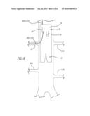 ENDOLUMINAL PROSTHESIS HAVING MODULAR BRANCHES AND METHODS OF DEPLOYMENT diagram and image