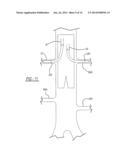 ENDOLUMINAL PROSTHESIS HAVING MODULAR BRANCHES AND METHODS OF DEPLOYMENT diagram and image