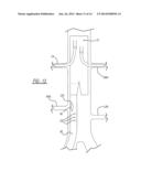 ENDOLUMINAL PROSTHESIS HAVING MODULAR BRANCHES AND METHODS OF DEPLOYMENT diagram and image