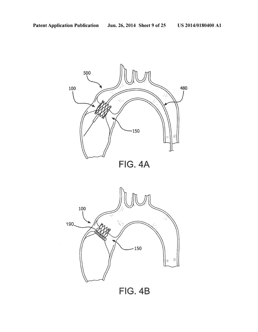 PROSTHETIC VALVES, FRAMES AND LEAFLETS AND METHODS THEREOF - diagram, schematic, and image 10