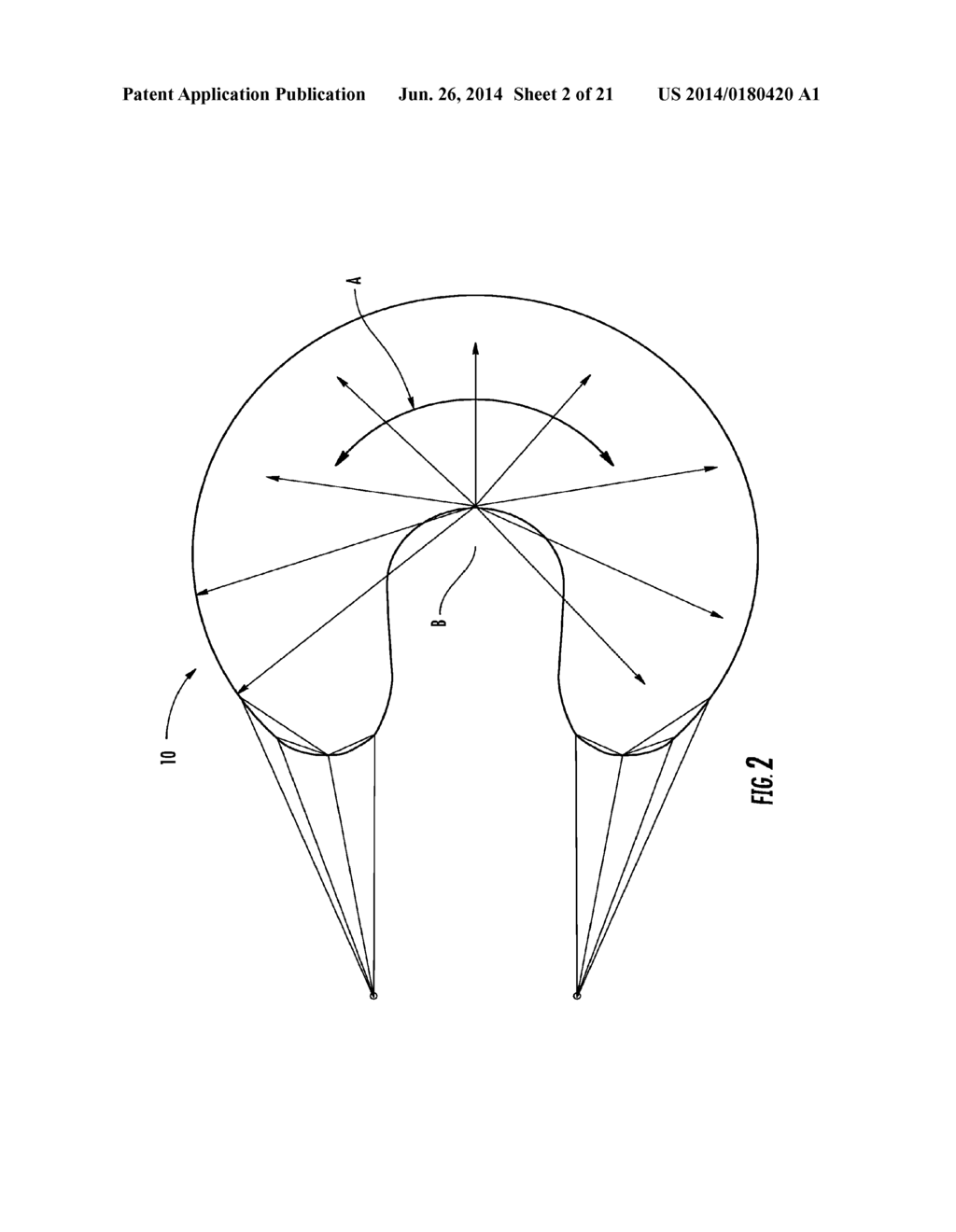 TISSUE ENGINEERED FIBROCARTILAGE REPLACEMENT - diagram, schematic, and image 03