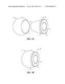 BALL JOINT PROSTHESIS AND METHOD diagram and image