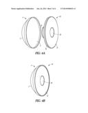 BALL JOINT PROSTHESIS AND METHOD diagram and image