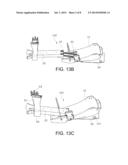 Knee Pad Support Frame diagram and image