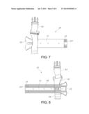 Knee Pad Support Frame diagram and image