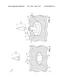 FASTENER diagram and image