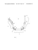 THREE PIECE LIFT ARM APPARATUS AND METHOD diagram and image