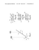 EYE ALIGNMENT ASSEMBLY diagram and image