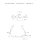 REMOVABLE ROUNDED MIDSOLE STRUCTURES AND CHAMBERS WITH COMPUTER     PROCESSOR-CONTROLLED VARIABLE PRESSURE diagram and image