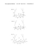 REMOVABLE ROUNDED MIDSOLE STRUCTURES AND CHAMBERS WITH COMPUTER     PROCESSOR-CONTROLLED VARIABLE PRESSURE diagram and image