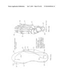 REMOVABLE ROUNDED MIDSOLE STRUCTURES AND CHAMBERS WITH COMPUTER     PROCESSOR-CONTROLLED VARIABLE PRESSURE diagram and image