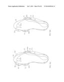 REMOVABLE ROUNDED MIDSOLE STRUCTURES AND CHAMBERS WITH COMPUTER     PROCESSOR-CONTROLLED VARIABLE PRESSURE diagram and image