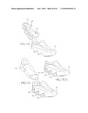 REMOVABLE ROUNDED MIDSOLE STRUCTURES AND CHAMBERS WITH COMPUTER     PROCESSOR-CONTROLLED VARIABLE PRESSURE diagram and image