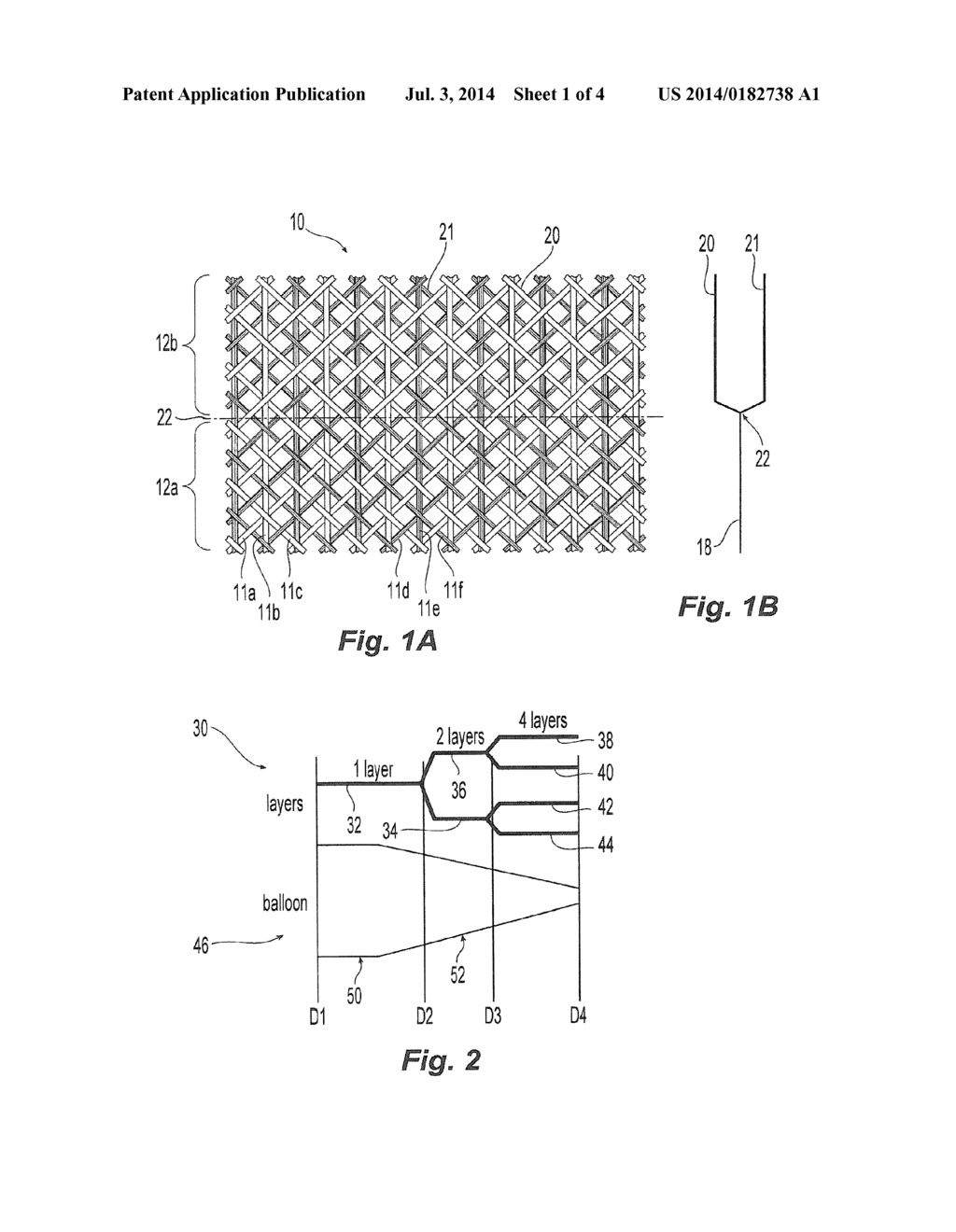 BALLOON WITH DIVIDING FABRIC LAYERS AND METHOD FOR BRAIDING OVER     THREE-DIMENSIONAL FORMS - diagram, schematic, and image 02