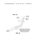 FLEXIBLE BACK SUPPORT MEMBER WITH INTEGRATED RECLINE STOP NOTCHES diagram and image