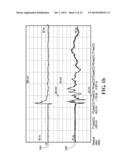 In-tool ESD Events Monitoring Method And Apparatus diagram and image