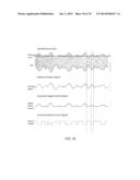 Control Systems and Methods for Power Amplifiers Operating in Envelope     Tracking Mode diagram and image