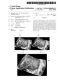 STEREOSCOPIC VOLUME RENDERING IMAGING SYSTEM diagram and image