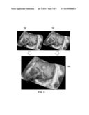 STEREOSCOPIC VOLUME RENDERING IMAGING SYSTEM diagram and image