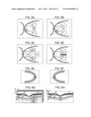 Ophthalmological Apparatus, Alignment Method, and Non-Transitory Recording     Medium diagram and image