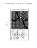 Ophthalmological Apparatus, Alignment Method, and Non-Transitory Recording     Medium diagram and image