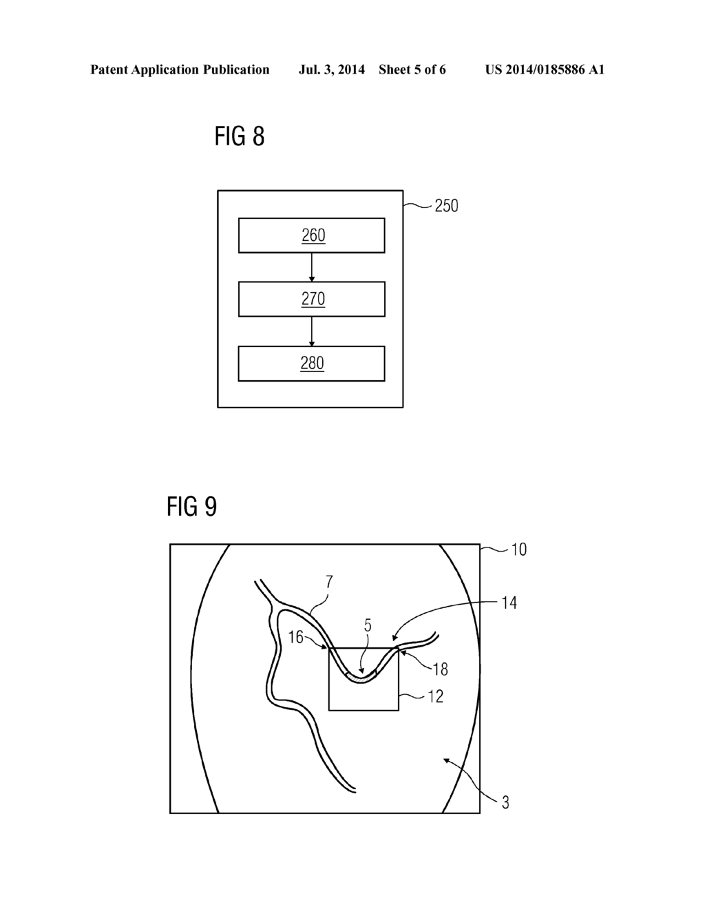 METHOD OF SELECTING A STENT BASED ON STRESS OF A BLOOD VESSEL - diagram, schematic, and image 06