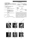 METHOD AND SYSTEM FOR LESION CANDIDATE DETECTION diagram and image