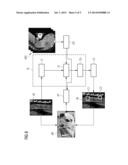 METHOD AND SYSTEM FOR LESION CANDIDATE DETECTION diagram and image