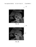 METHODS AND SYSTEMS FOR AUTOMATED SOFT TISSUE SEGMENTATION, CIRCUMFERENCE     ESTIMATION AND PLANE GUIDANCE IN FETAL ABDOMINAL ULTRASOUND IMAGES diagram and image