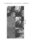 Use of Stem Cells to Prevent Neuronal Dieback diagram and image