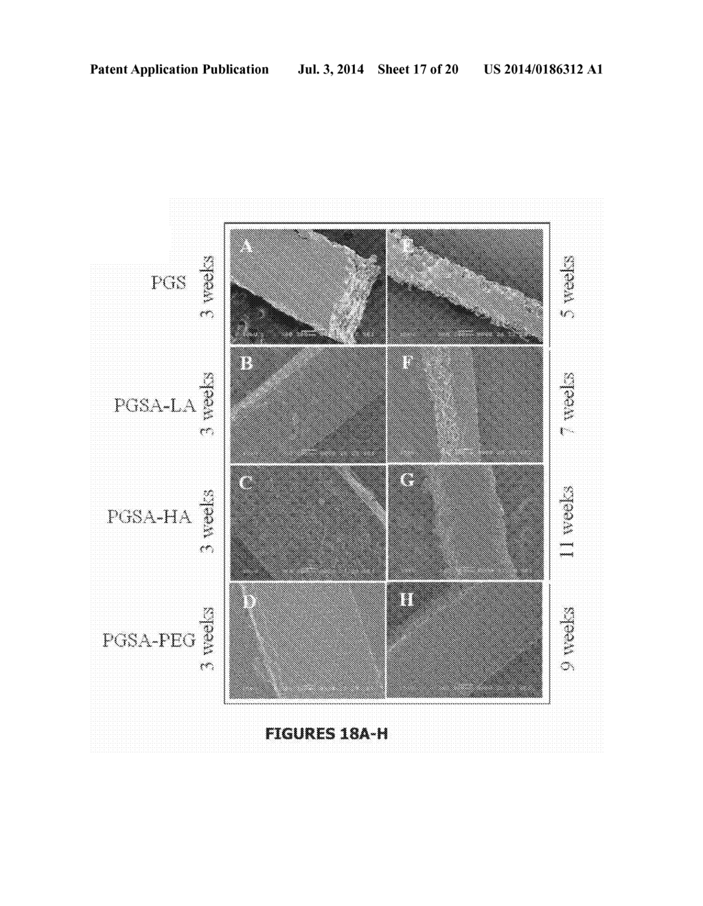 Method Comprising Contacting Tissue With a Cross-Linkable Polyester     Prepolymer - diagram, schematic, and image 18