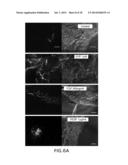 COMPOSITIONS AND METHODS FOR TREATING OCULAR DISEASES AND CONDITIONS diagram and image