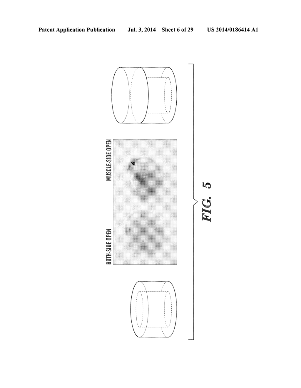 METHODS AND USES FOR EX VIVO TISSUE CULTURE SYSTEMS - diagram, schematic, and image 07