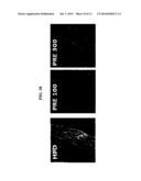 COMPOSITION FOR TREATING OBESITY AND DIABETES AND FOR INCREASING MUSCLE     MASS AND IMPROVING CAPACITY FOR EXERCISE, COMPRISING EXTRACTS OF PIPER     RETROFRACTUM VAHL. FRUITS AS ACTIVE INGREDIENTS diagram and image