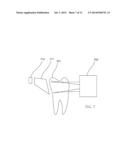 INFRARED DENTAL IMAGING diagram and image