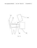 INFRARED DENTAL IMAGING diagram and image