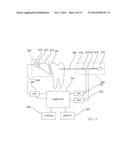 INFRARED DENTAL IMAGING diagram and image