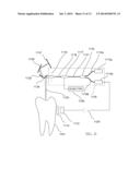 INFRARED DENTAL IMAGING diagram and image