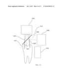 INFRARED DENTAL IMAGING diagram and image