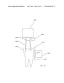 INFRARED DENTAL IMAGING diagram and image