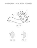 DEVICE, SYSTEM AND METHODS FOR DETERMINING AND MEASURING TEMPOROMANDIBULAR     JOINT POSITIONS AND MOVEMENTS diagram and image