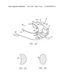 DEVICE, SYSTEM AND METHODS FOR DETERMINING AND MEASURING TEMPOROMANDIBULAR     JOINT POSITIONS AND MOVEMENTS diagram and image