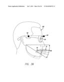 DEVICE, SYSTEM AND METHODS FOR DETERMINING AND MEASURING TEMPOROMANDIBULAR     JOINT POSITIONS AND MOVEMENTS diagram and image