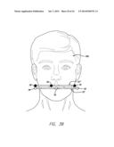 DEVICE, SYSTEM AND METHODS FOR DETERMINING AND MEASURING TEMPOROMANDIBULAR     JOINT POSITIONS AND MOVEMENTS diagram and image