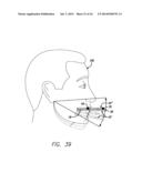 DEVICE, SYSTEM AND METHODS FOR DETERMINING AND MEASURING TEMPOROMANDIBULAR     JOINT POSITIONS AND MOVEMENTS diagram and image